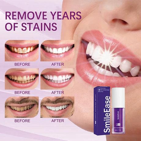 Hismile V34 Purple Whitening Toothpaste – Teeth Brightening and Color Corrector