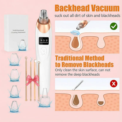 4‑in‑1 Blackhead Removal Suction Machine – Cell Operated