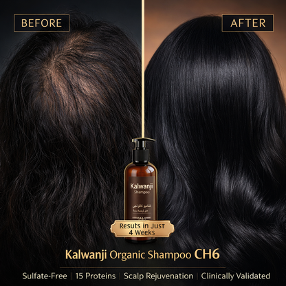 Organic Kalwanji Shampoo CH6 – Black Seed Hair Cleanser